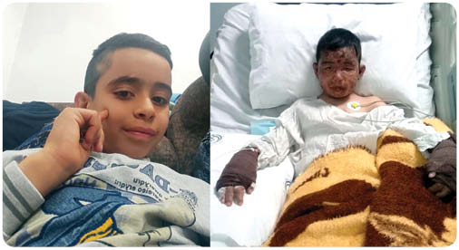 قهرمانان کوچک گمنام/ پسر 8 ساله شیرازی، 4 کودک را از میان آتش نجات داد